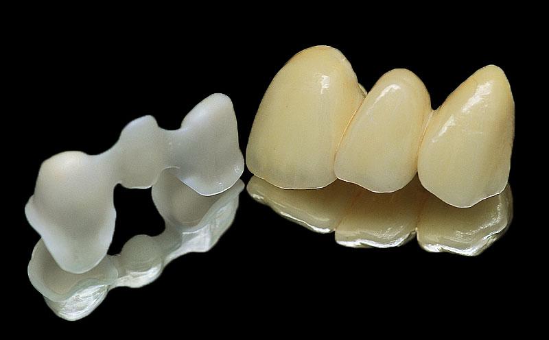 Layered Zirconia