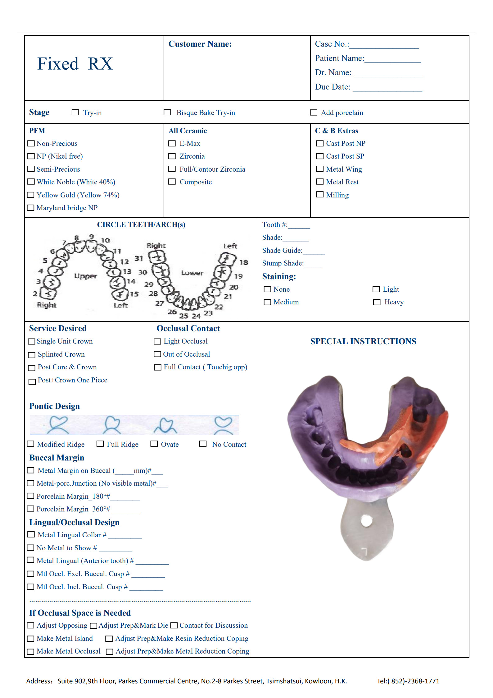 Fixed dental restoration from SKY Dental Lab