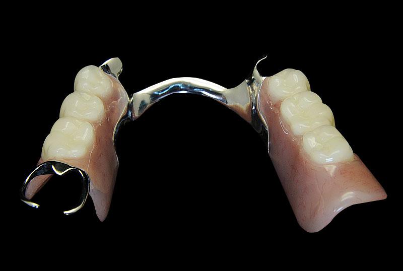 Framework+acrylic-denture