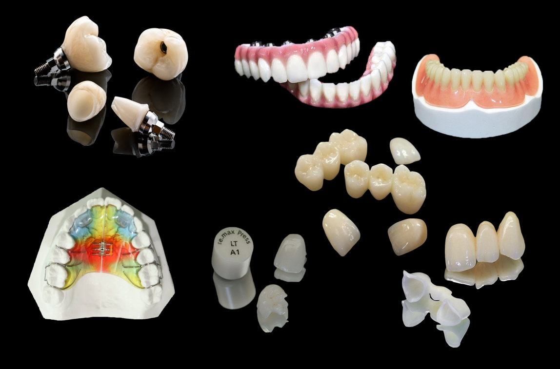 Fixed dental restoration from SKY Dental Lab