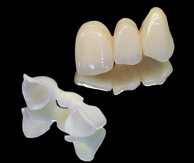 E.Max Bridge