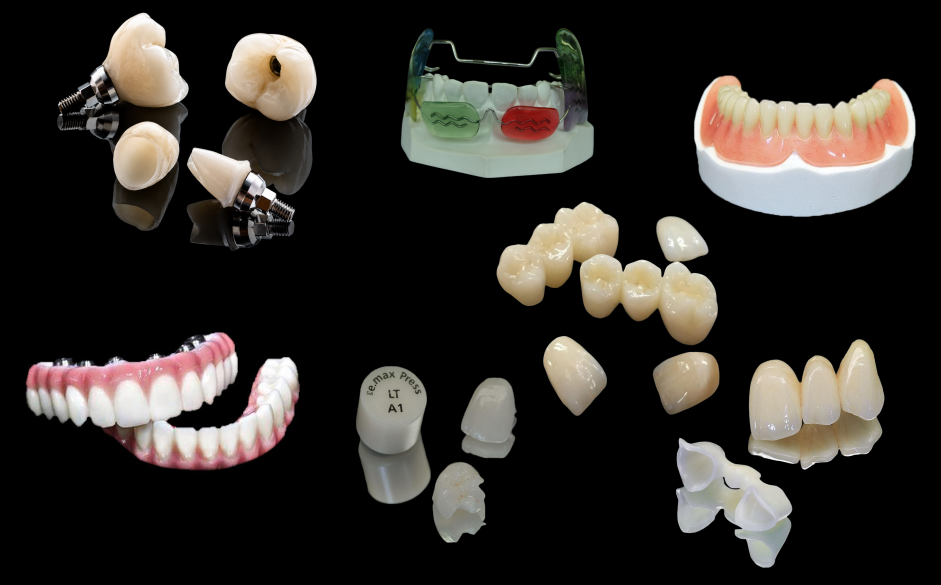 Fixed dental restoration from SKY Dental Lab
