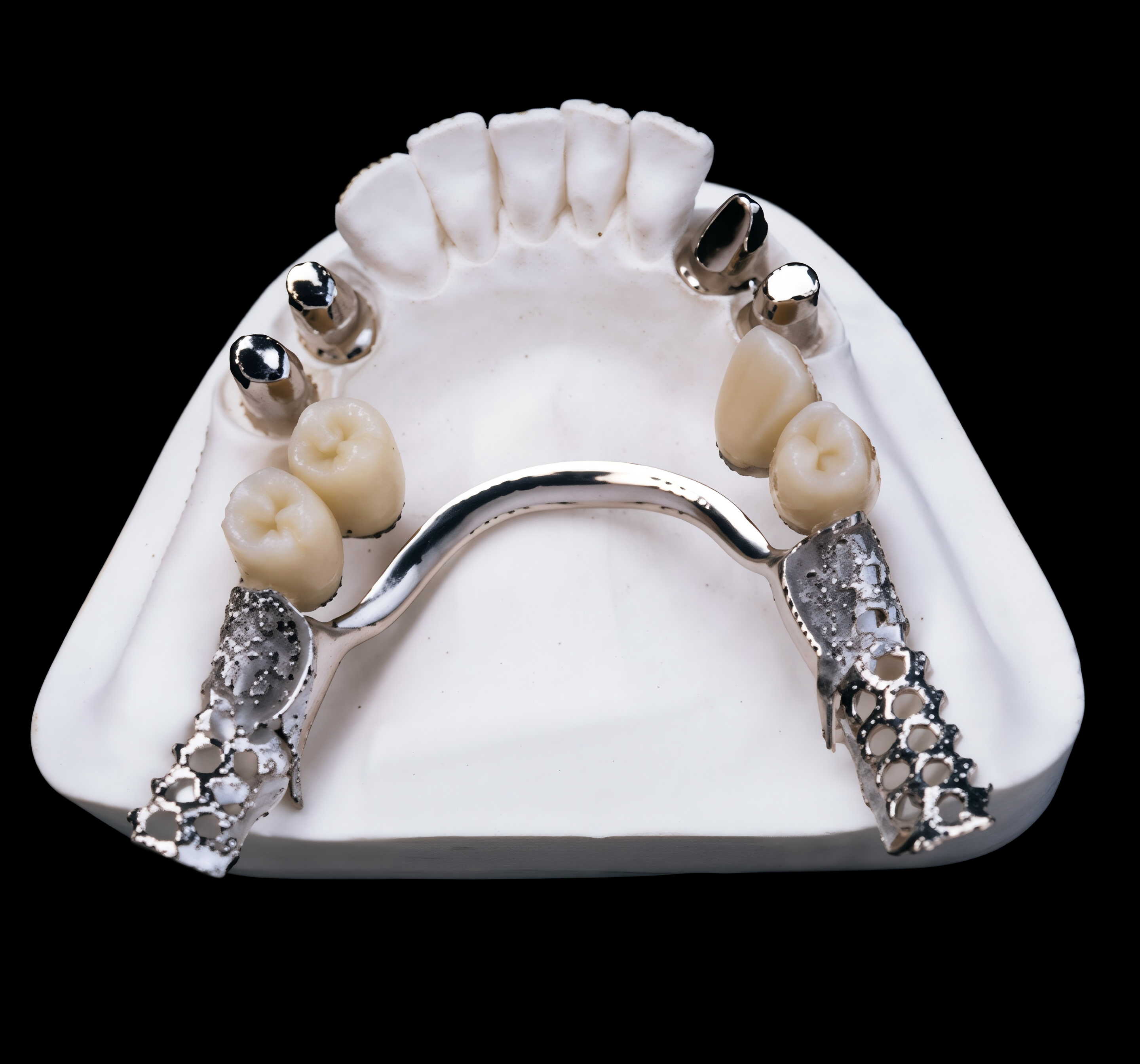 Telescopic Crown