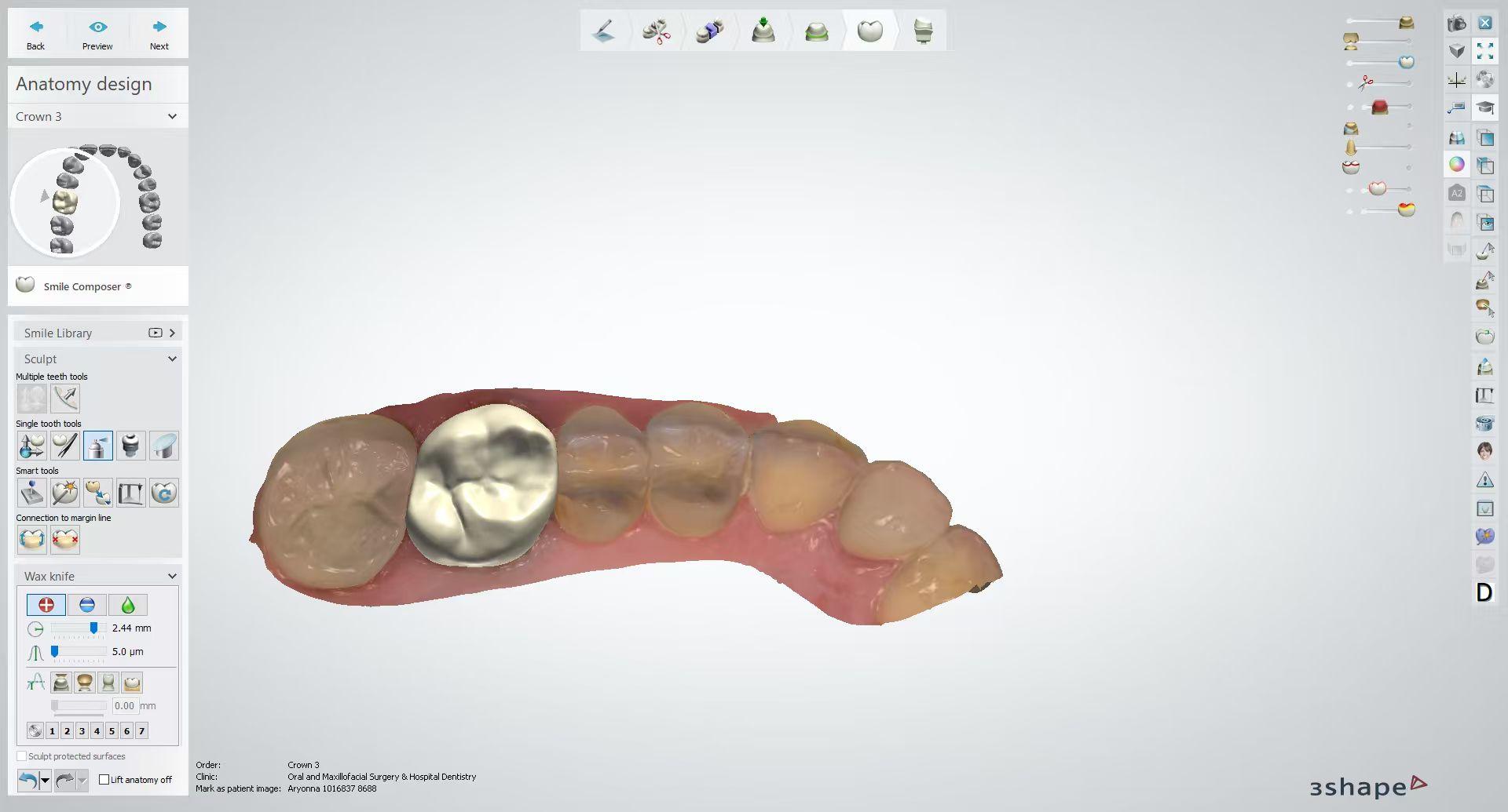Case review and digital design