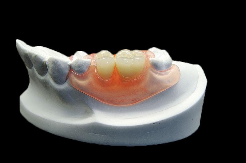 Valplast