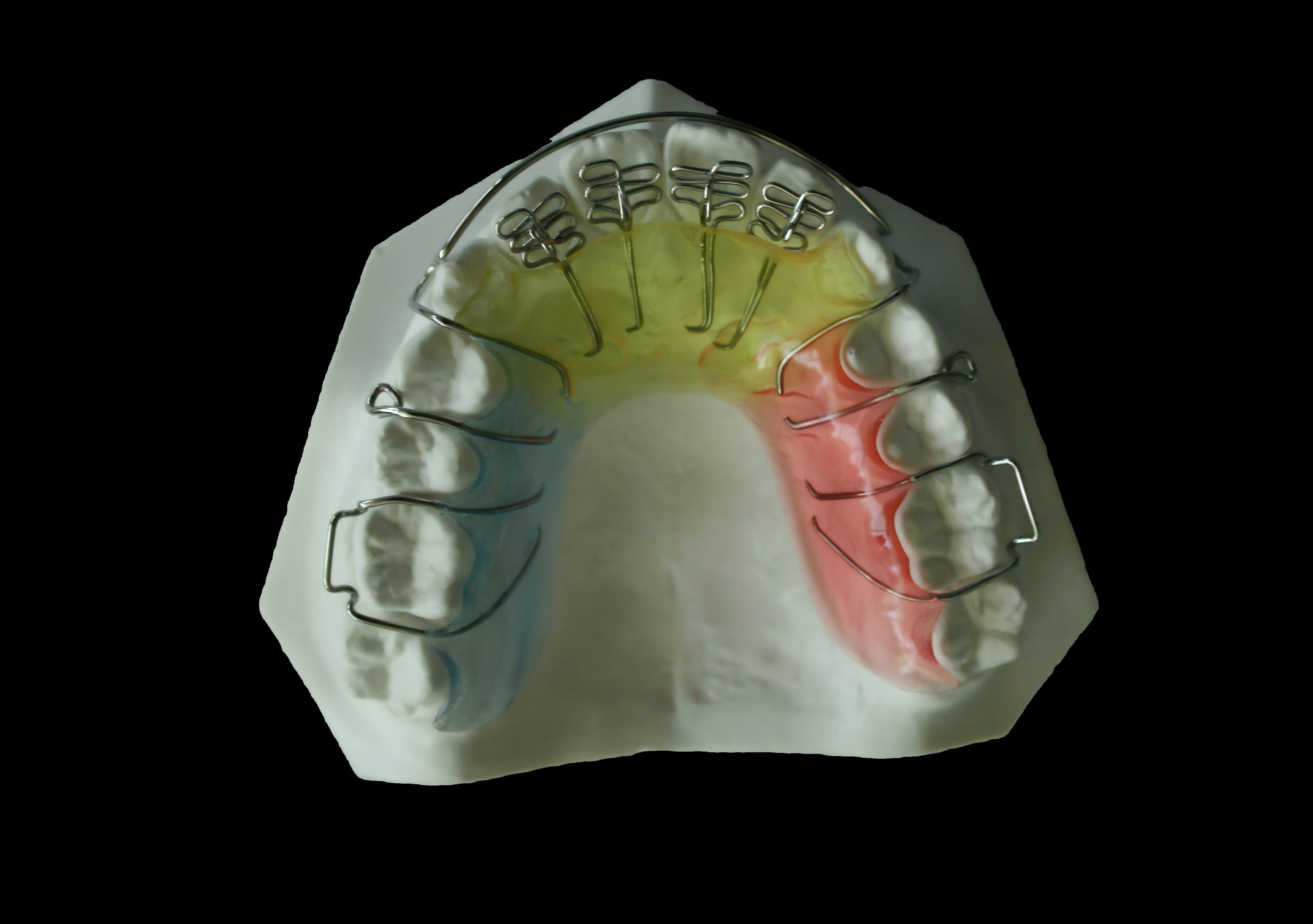 Hawley Retainer