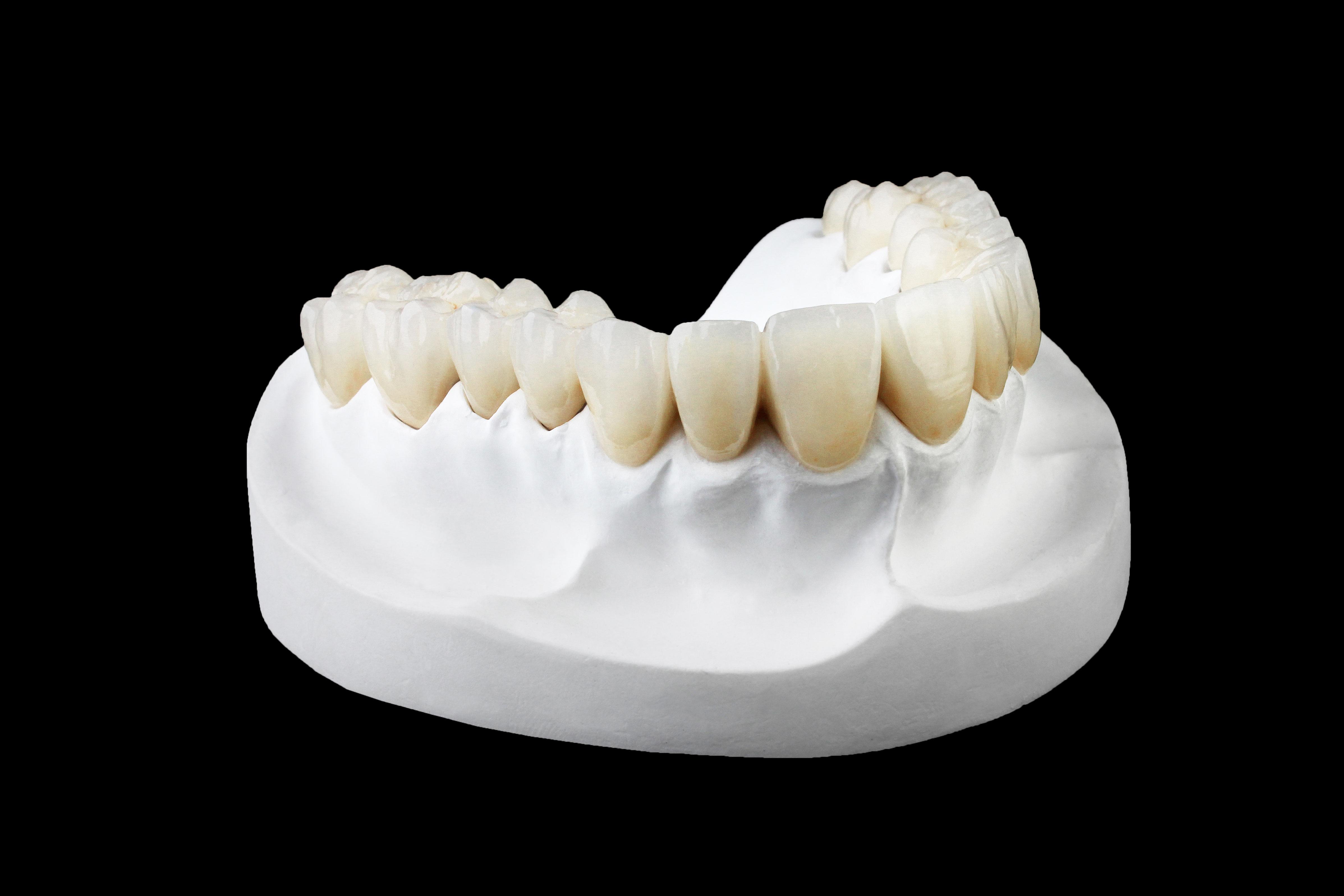Full Zirconia